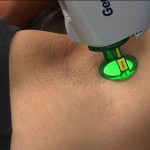 Laser Hair Removal Laser Hair Removal
