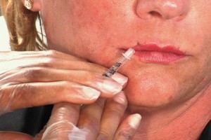 Botox Injection Techniques - Learn How to Inject Botox Botox Injection Techniques - Learn How to Inject Botox