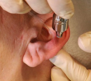 Medical Aesthetician Training - Microdermabrasion Techniques - Diamond Tip Microdermabrasion Machines - Stainless Steel Tip Microdermabrasion Machines Medical Aesthetician Training - Microdermabrasion Techniques - Diamond Tip Microdermabrasion Machines - Stainless Steel Tip Microdermabrasion Machines